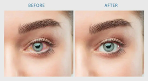 Sclera White eye whitening supplement 2 pack bundle with capsules spilling out.